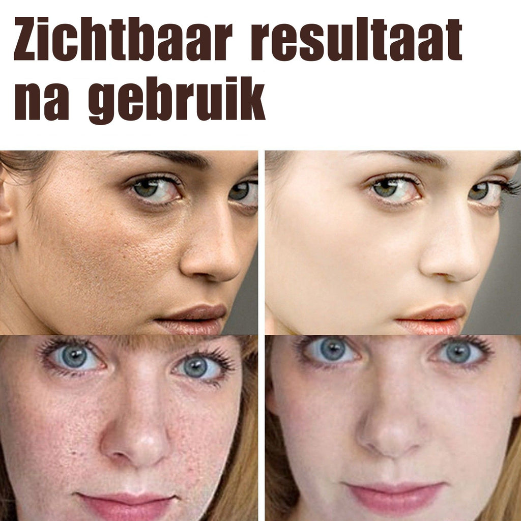 EELHOE™ Retinol Crème