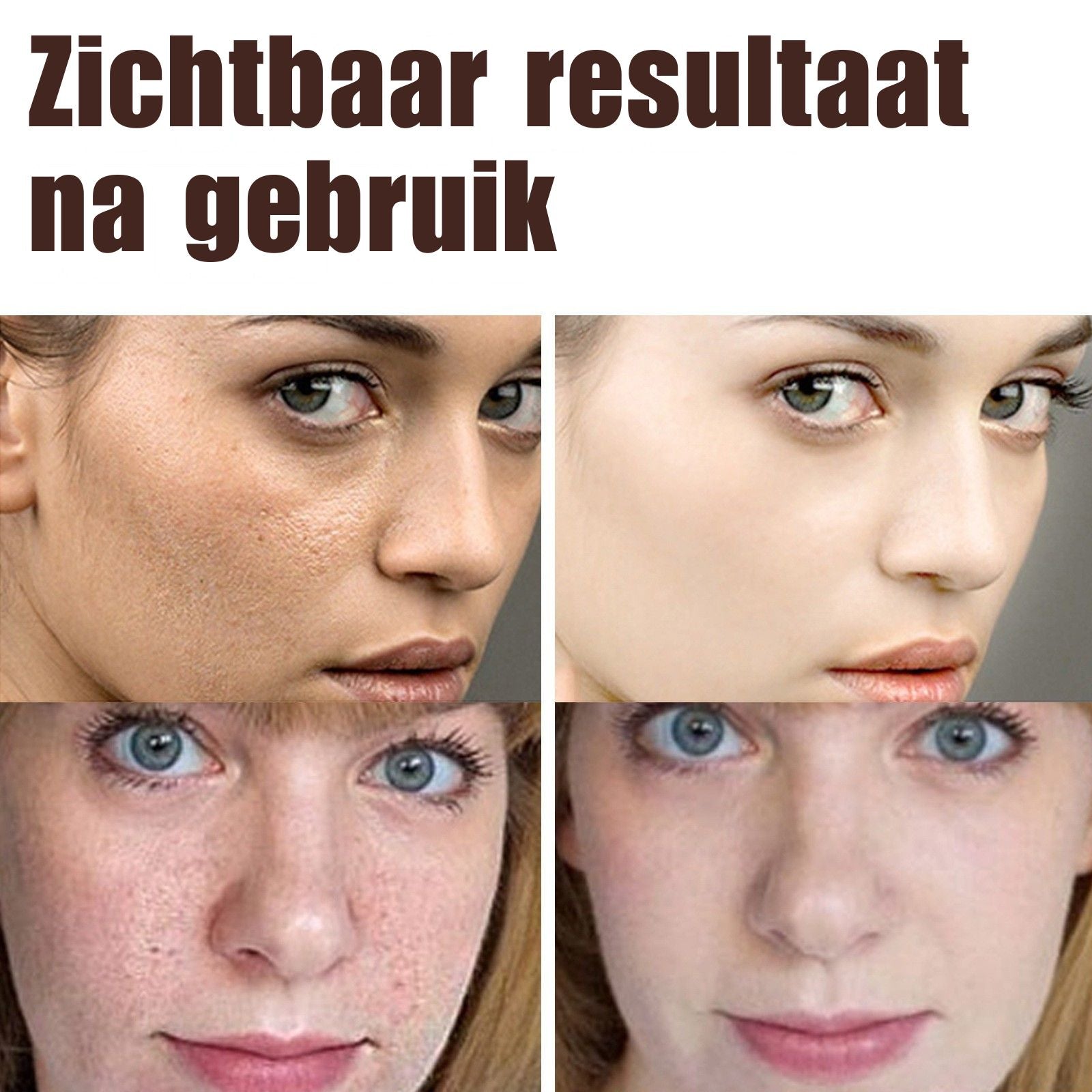 EELHOE™ Retinol Crème