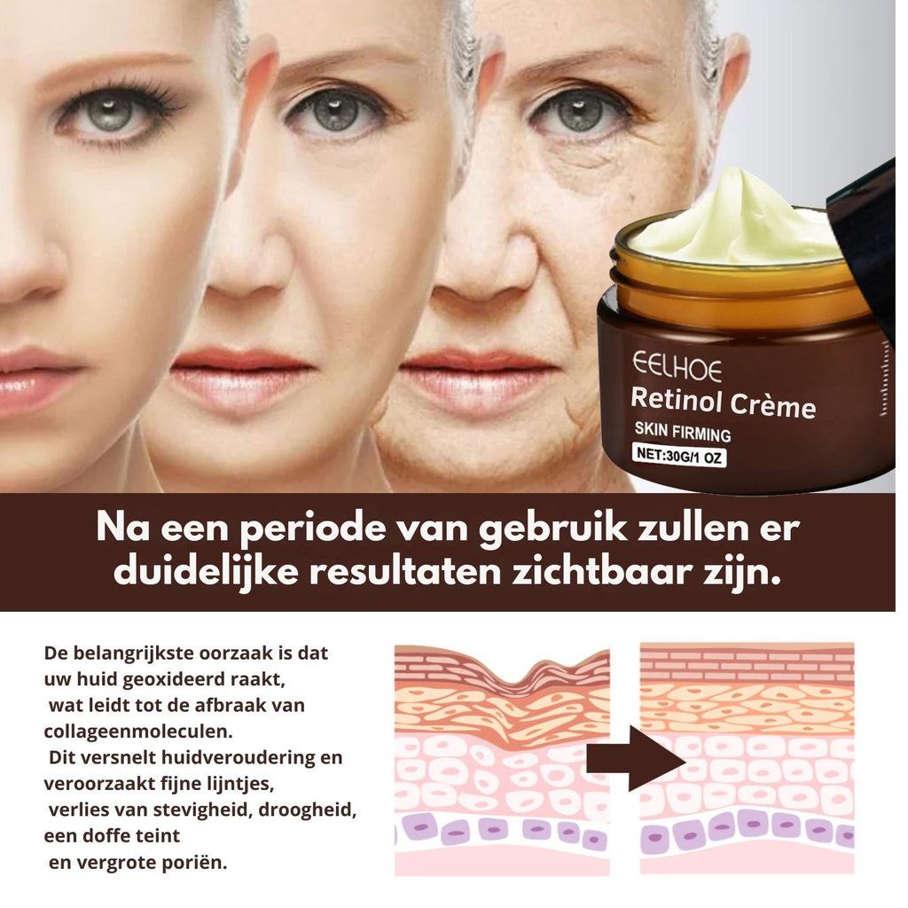 EELHOE™ Retinol Crème